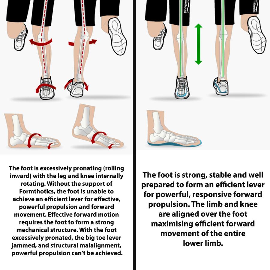 Diagram Of Formthotics Run Dual Orthotics - Dark Green/Blue