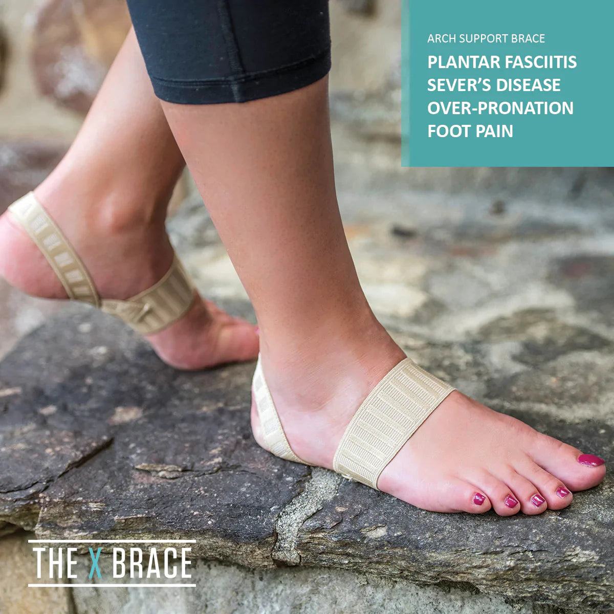 THE X BRACE PREMIER TREATMENT FOR FOOT PAIN