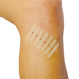 Steristrips